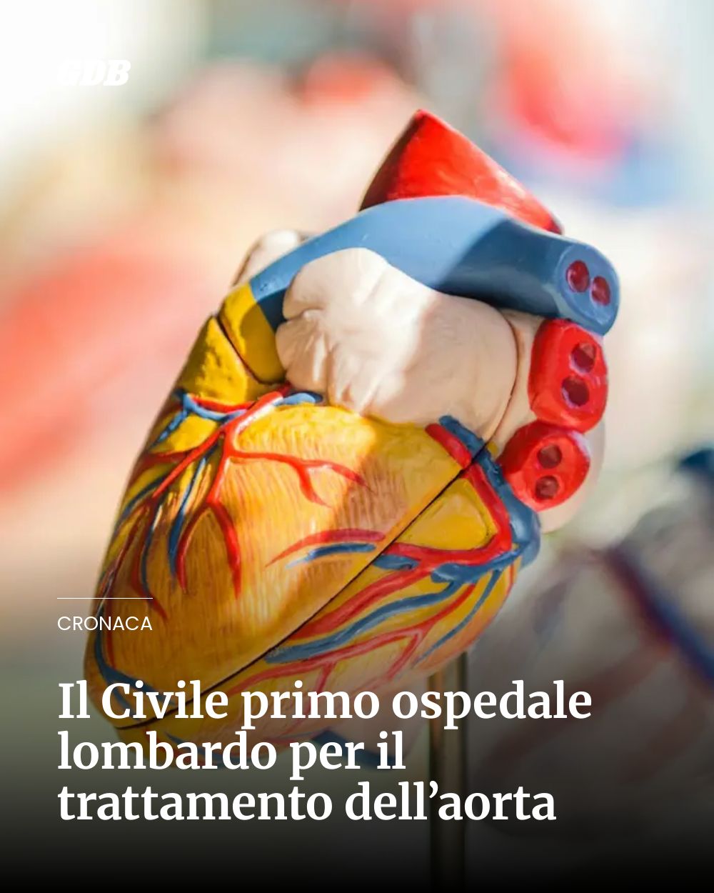 Post Instagram @giornaledibrescia: Il Civile primo ospedale lombardo per il trattamento dell’aorta...