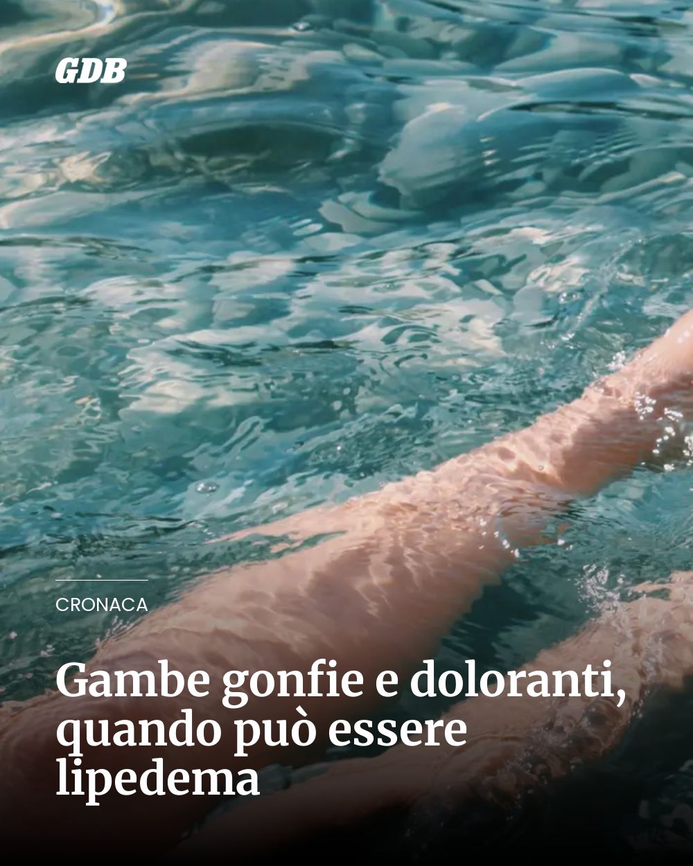 Post Instagram @giornaledibrescia: Gambe gonfie e doloranti, quando può essere lipedema...