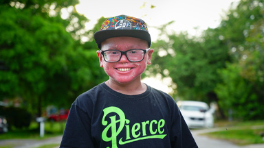 The Teen Whose Skin Grows Too Fast