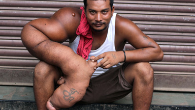 My Gigantic Arm: One man's journey to find happiness
