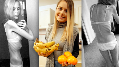 Hours From Death: Anorexia Sufferer's Incredible Recovery
