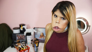 Inspirational Vlogger Redefines Beauty: BORN DIFFERENT