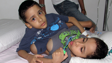 Programme Reveals Moving Story of Twin Boys Joined At The Hip - and Their Separation Surgery