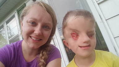 My Incredible Son With No Eyes