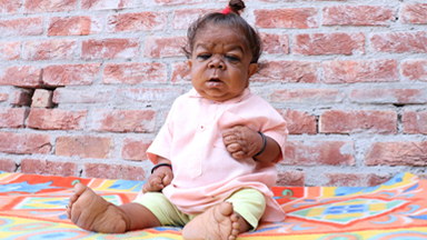 Man Stopped Growing At Six Months Old Is Now 21 And Only 23 Inches Tall