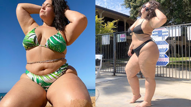 Lymphedema Warrior Embraces Her Bikini Body