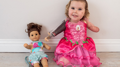 Brave Toddler Keeps Smiling Despite Losing Limbs