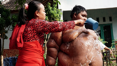 423lbs Ten­-Year-­Old Has Life Threatening Obesity