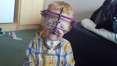 Inspirational Little Boy with rare genetic disorder defies the odds of condition