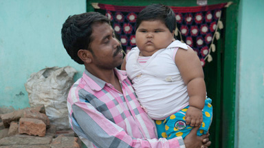 53lb Toddler: Indian Girl Is One Of The World's Heaviest For Her Age