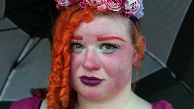 “I am Burning Alive”: Girl Suffers From Rare Skin Condition