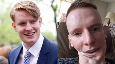 Cancer Ate My Jaw Away