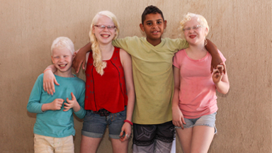 My Albino Children: Black Brazilian Family Have Three White Children