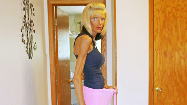 The Woman Who Can't Eat: Rare Medical Condition Causes Her Involuntary Starvation