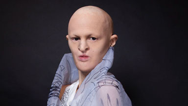 Woman With Rare Genetic Condition Defies Stereotypes To Become Hit Model