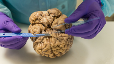 The Man Slicing Up Brains For Parkinson’s Research