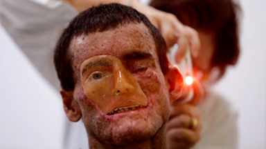 Life In The Shadows: The Brazilian Village Allergic To Sunlight