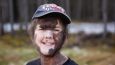 Boy With Giant Mole Beats The Bullies