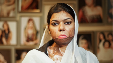 Fighting Back: Salon For Acid Attack Victims