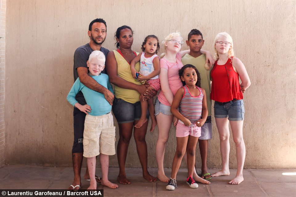 My Albino Children Black Brazilian Family Have Three White Children