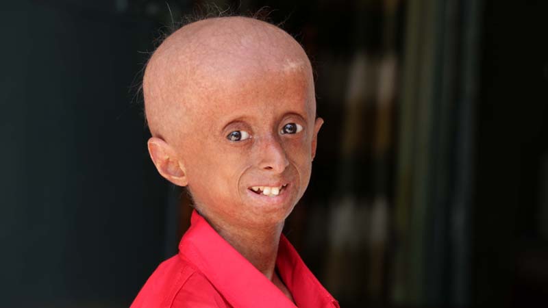 The Inspirational 11-Year-Old Who Looks 60