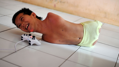 Limb-itless: Boy Born Without Arms And Legs Lives Life To The Fullest