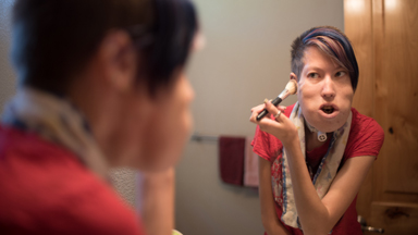 Girl with facial tumour beats bullies with her beautiful singing voice