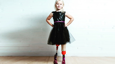 The Little Girl With No Legs And Big Dreams