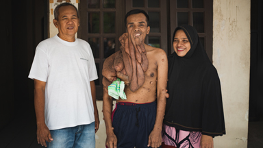 I'm Finally Having Surgery For My 30kg Tumours