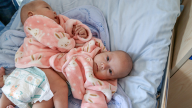 Two Precious: Conjoined Twin Boys Successfully Separated in Groundbreaking Operation