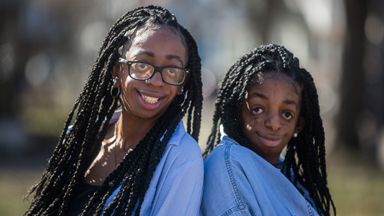 Inspirational Sisters Share Rare Facial Disorder