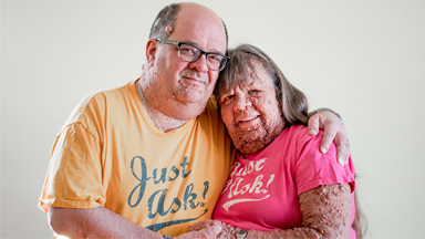 Husband & Wife With Thousands Of Tumours