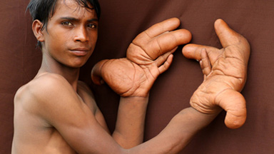 The Boy With The Giant Hands