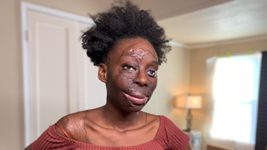I Wear My Scars Like Diamonds
