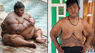 World’s Heaviest Kid Loses 220lbs