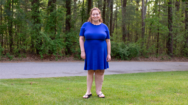 I’ve Had 50 Surgeries On My Giant Leg
