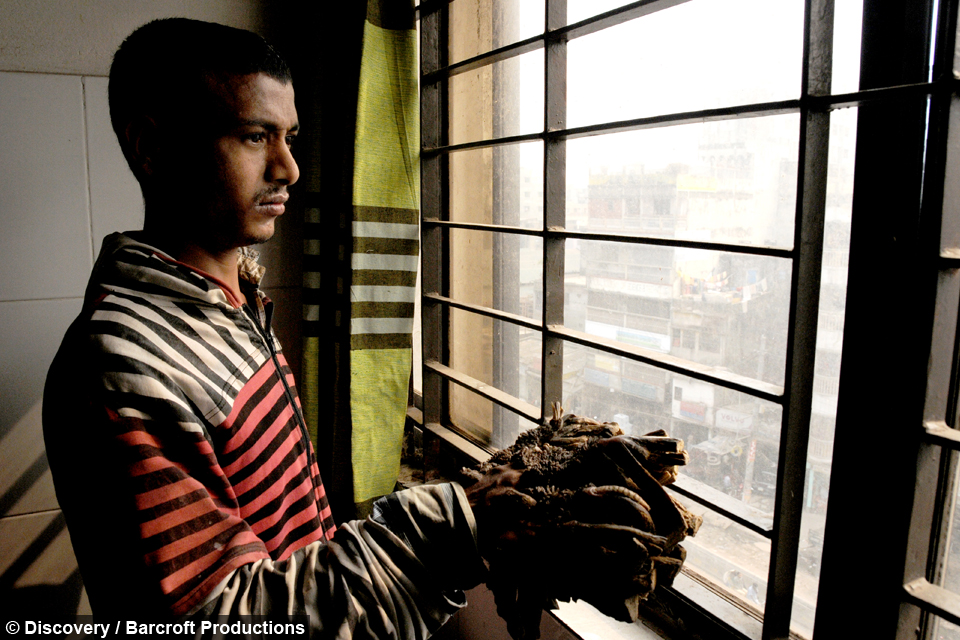 Tree man of Bangladesh given new lease of life