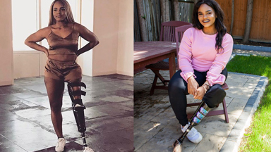 Empowered Teen Proud of Prosthetic Leg