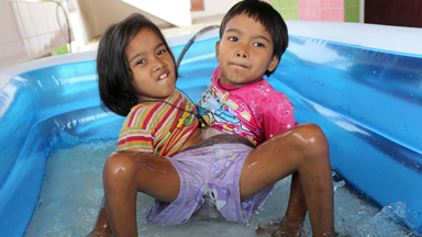 Perfect As We Are: Conjoined Twins Don’t Want To Be Separated