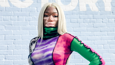 I Won’t Hide My Vitiligo