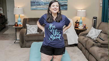 My 260lbs Weight Loss Left Me With 20lbs Of Loose Skin