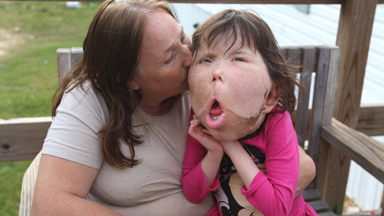 The Girl Who Doctors Can't Diagnose