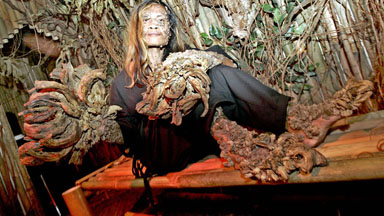 ‘Tree Man’ Dede Koswara dies aged 45 after long battle with illness
