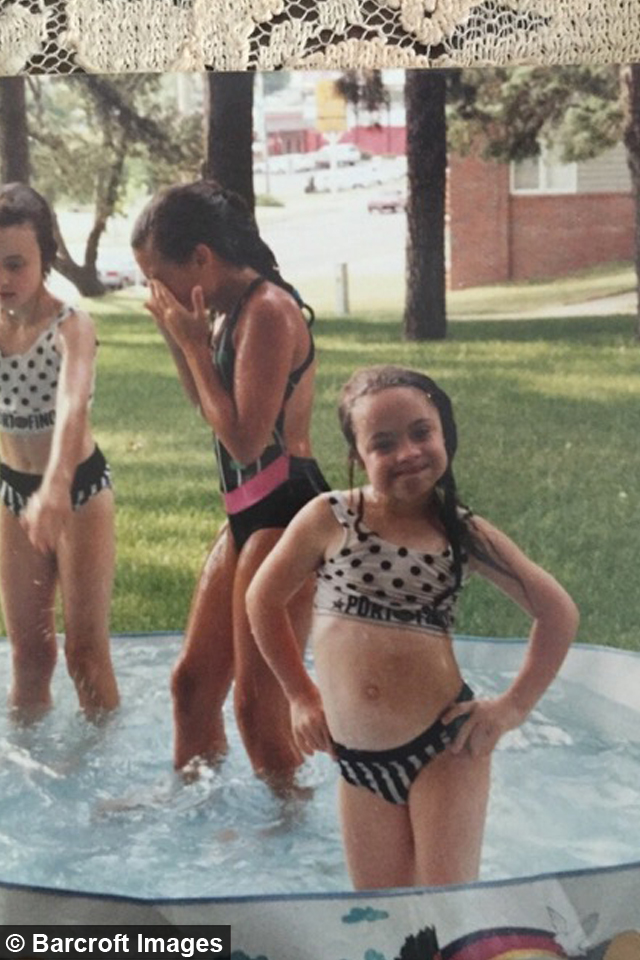 Girl with down syndrome in bikini pics 241
