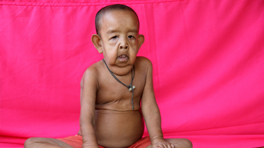 The Toddler Who Looks Like An Old Man