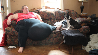 Grandmother With 112lb Growth On Her STOMACH Given Pioneering Surgery