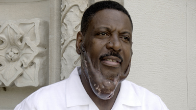 Man With Keloids Mentors Students Who Helped Save His Life