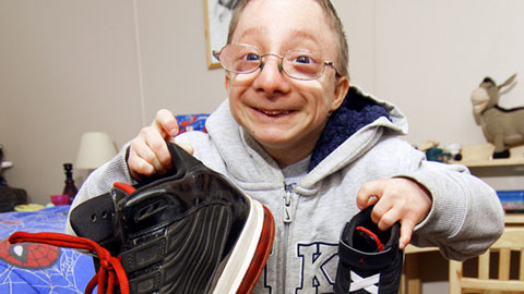 Little big brother: 35-inch tall primordial dwarf has 6ft5 siblings