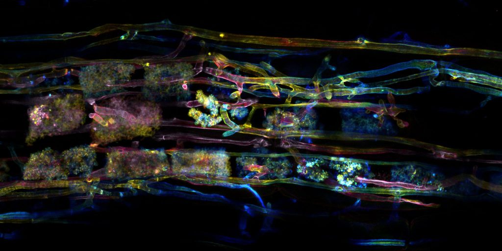 colourful confocal microscope image of symbiotic soil fungi in the roots cells of buttercup