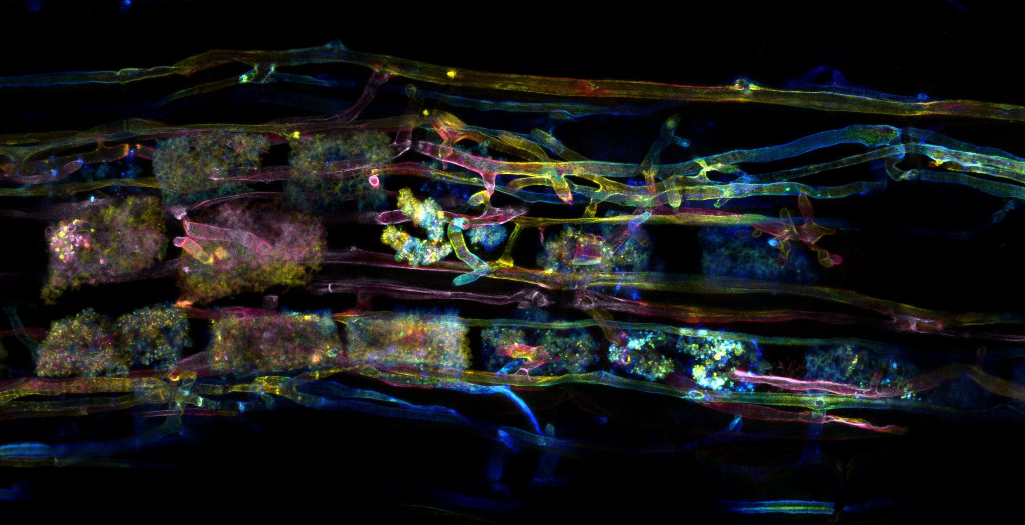 colourful confocal microscope image of symbiotic soil fungi in the roots cells of buttercup